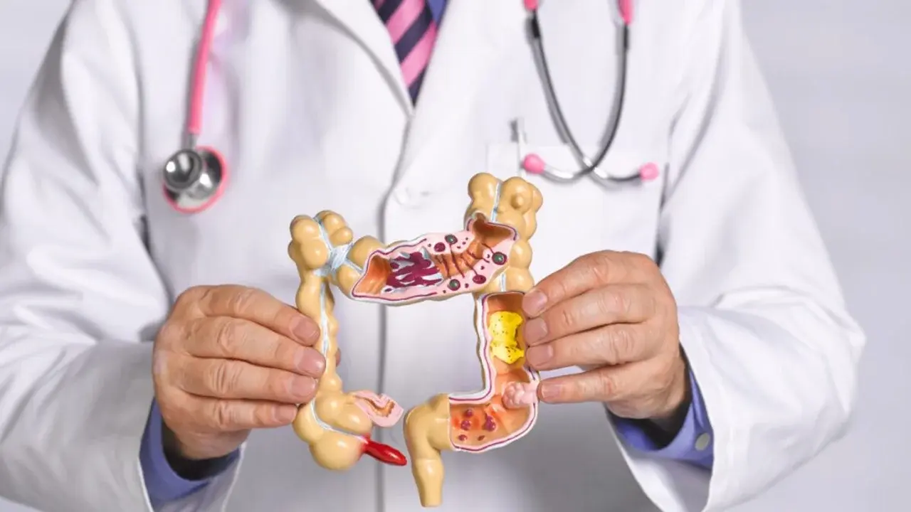 El cáncer de colon puede prevenirse y detectarse a tiempo.