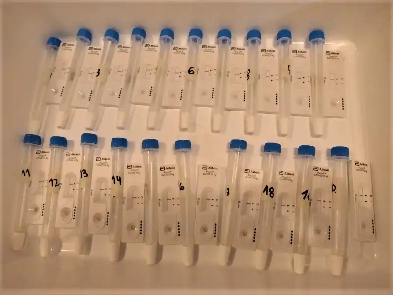 Fueron testeados de manera voluntaria más de 50 trabajadores municipales de Chascomús