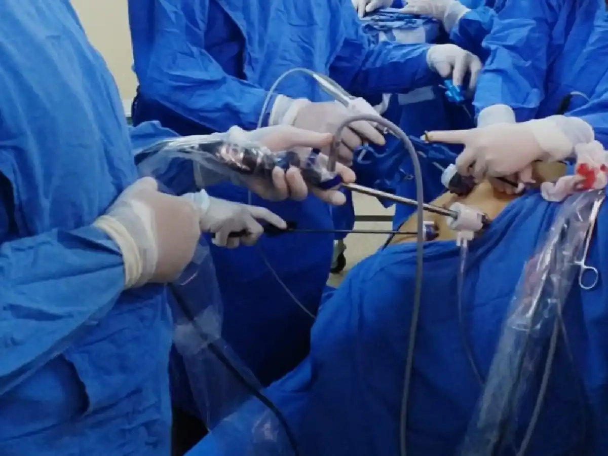 Extirparon un estómago por vía laparoscópica en la Clínica Regional del Este 