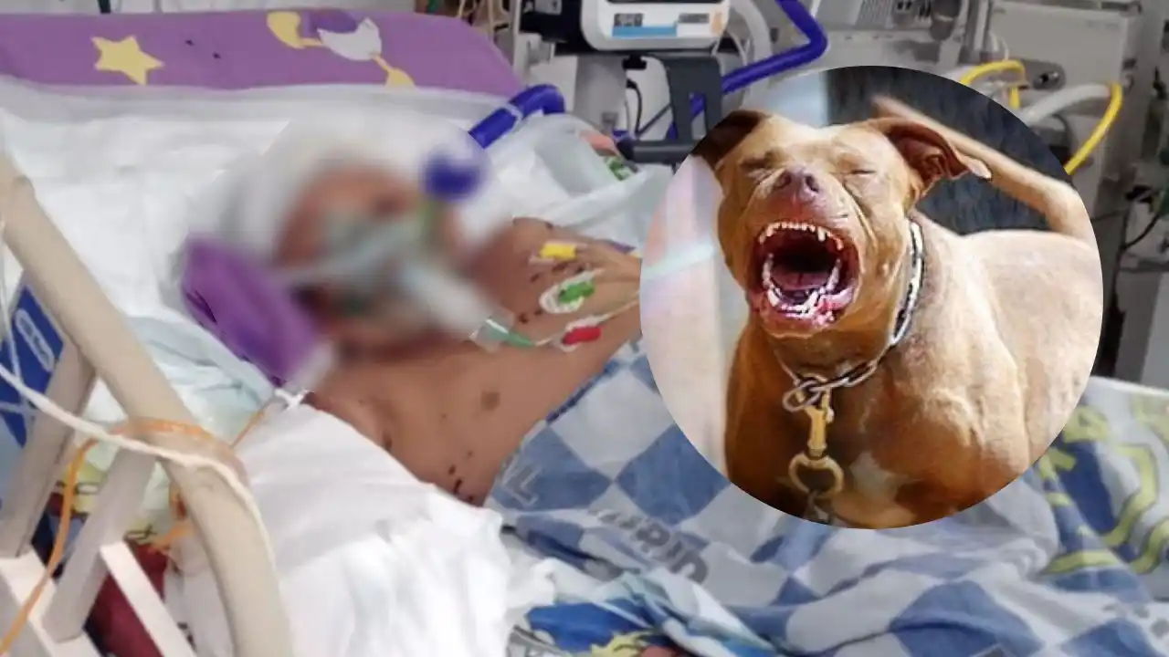 Niño fue atacado varias veces por dos perros callejeros en Ciudad Bolívar