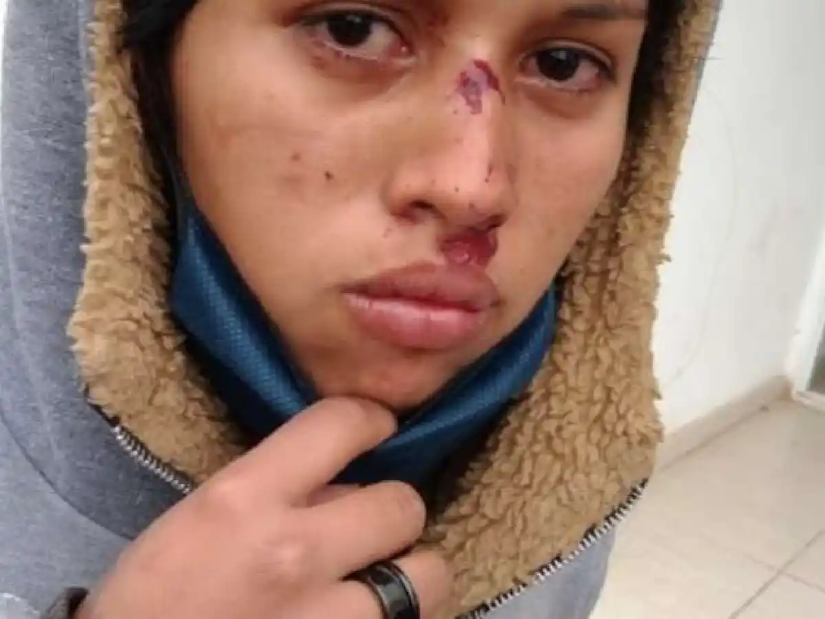 Chaco: Denuncian que policías abusaron y rociaron con alcohol a dos chicas Qom