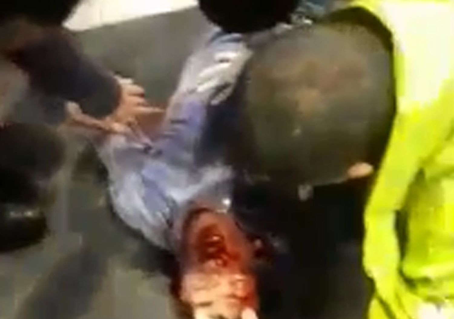 El video del momento que se llevaban al joven golpeado a la salida de un boliche