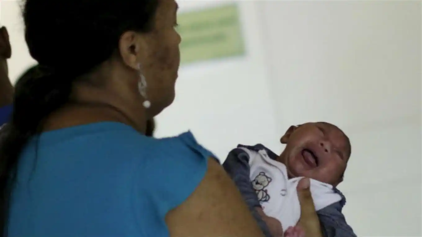 Muere un bebé en EE.UU. por microcefalia asociada al zika
