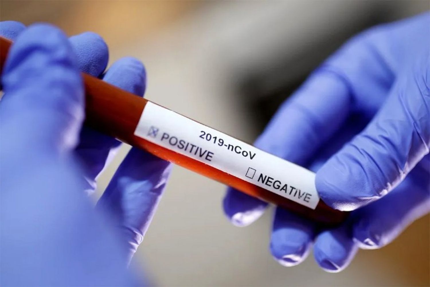 Cifra record: confirmaron 58 nuevos contagios en ocho departamentos