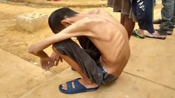 ¡TERRIBLE! 117 presos en el retén de Cabimas sufren de tuberculosis