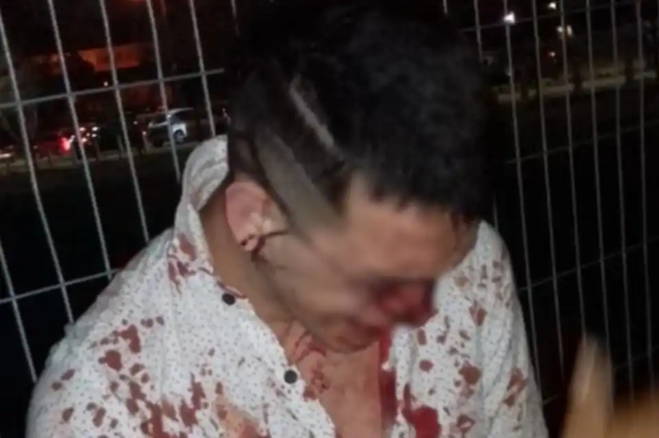 Un joven denunció haber sido brutalmente golpeado por un patovica