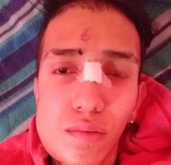 SIN PIEDAD golpean brutalmente a un trabajador venezolano en Argentina