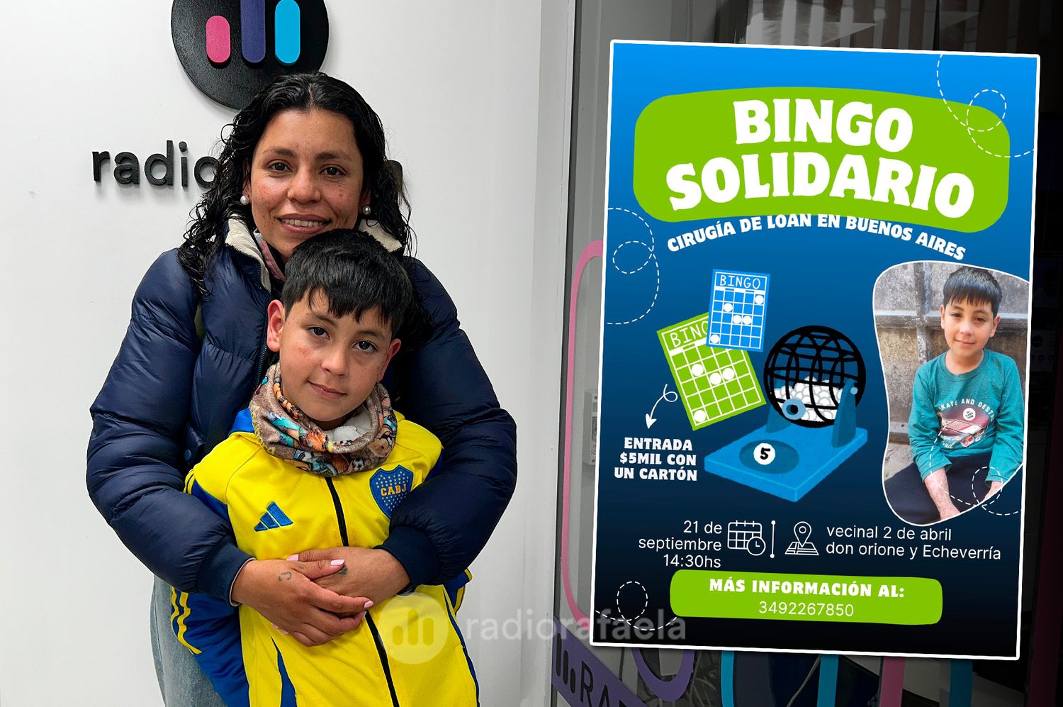 El pequeño rafaelino Loan necesita de tu ayuda para una nueva operación: sumate al bingo solidario