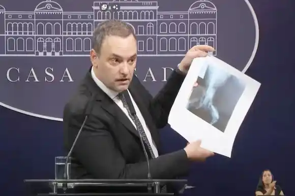 El Gobierno inicia auditorías en pensiones por invalidez por posibles fraudes