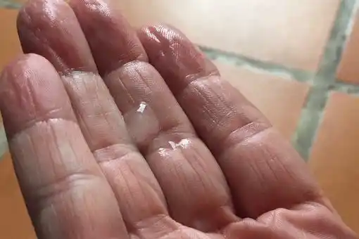 Reportan caída de granizo en la Gran Caracas este 15Oct