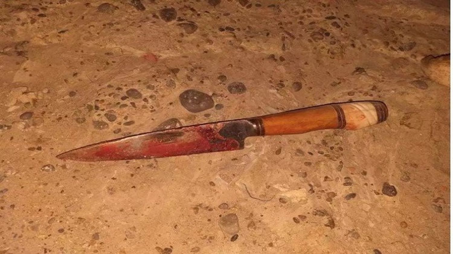Lo apuñalaron en el rostro por resistirse a un robo