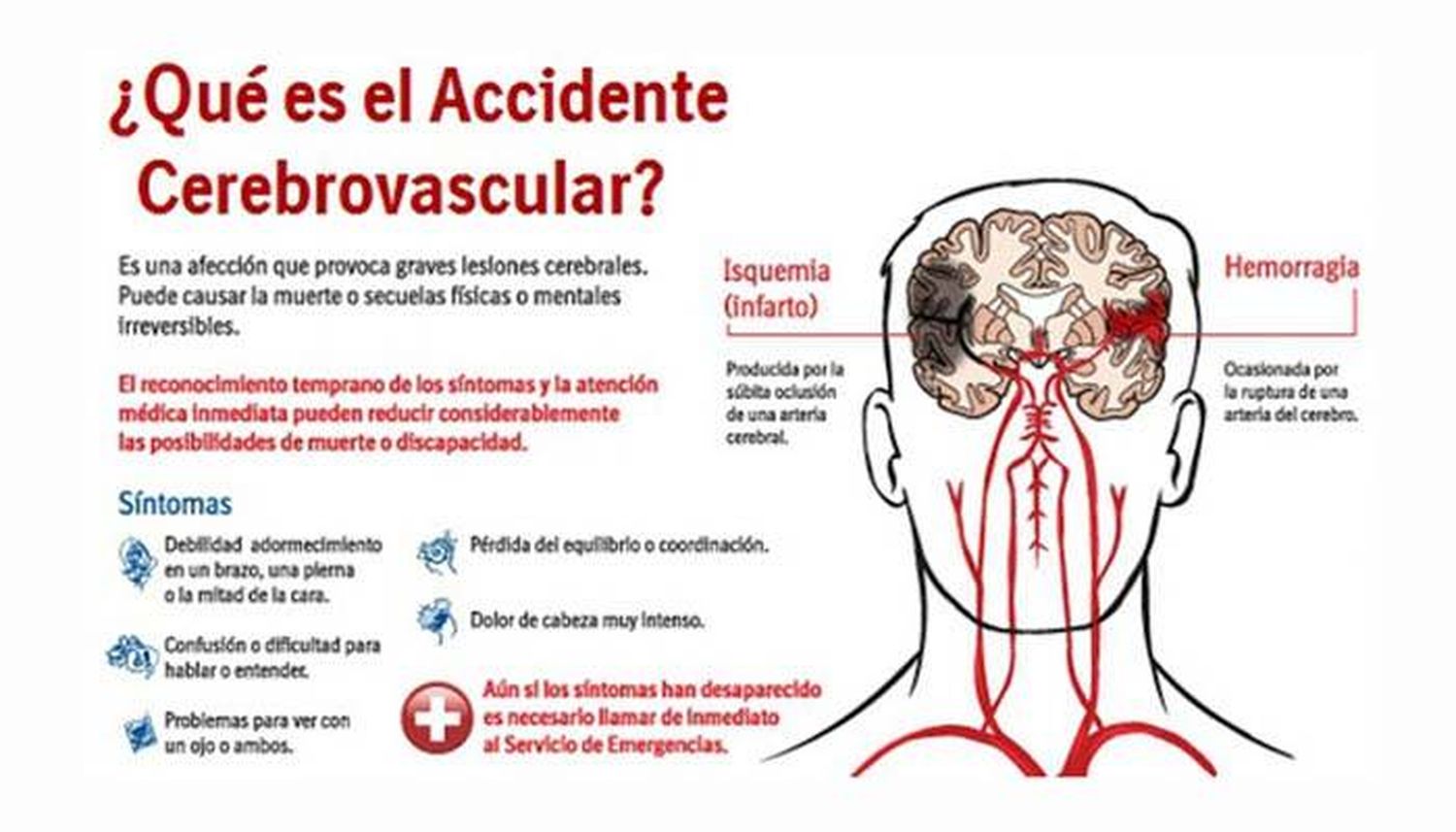 ¿Cuáles son los síntomas y qué podemos hacer ante una situación de ACV?