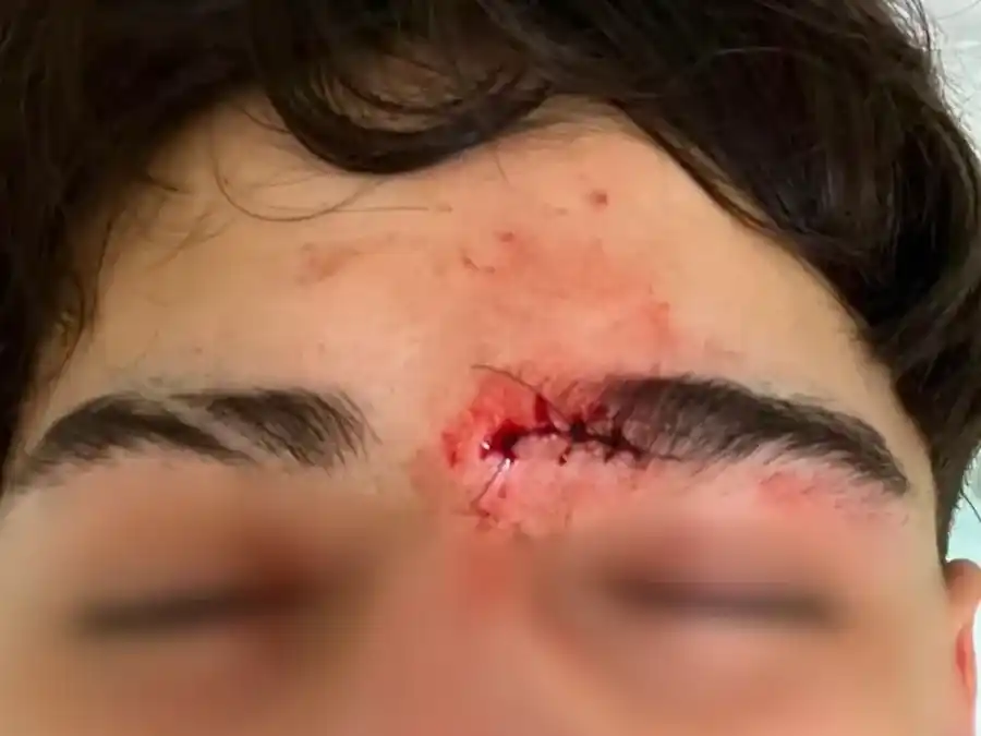 Uno de los adolescentes sufrió un profundo corte en el rostro.