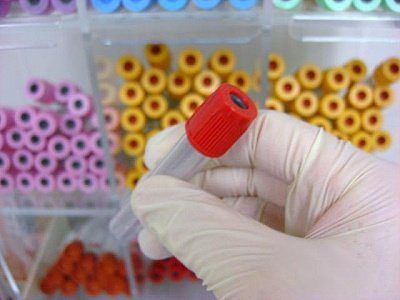 Colombia sobrepasa los 154 mil contagiados con COVID-19