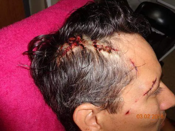Sigue el juicio a hermanos acusados de herir a policía