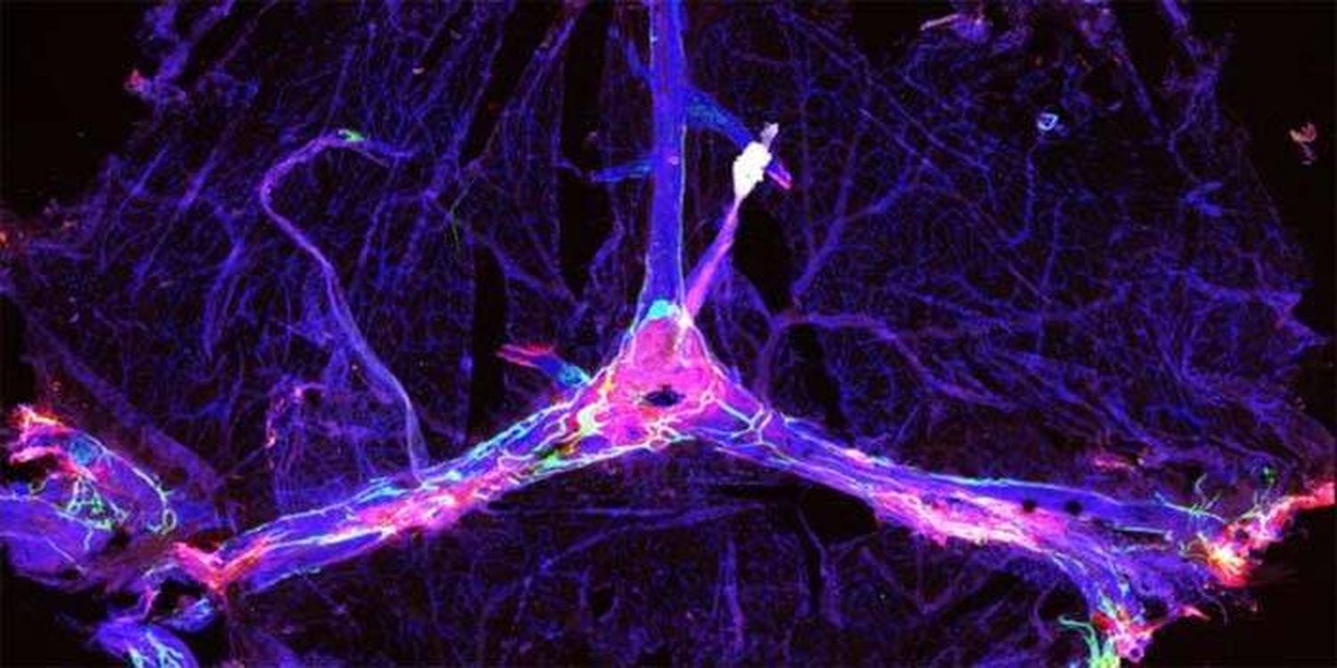 La aprobación de aducanumab, la gran oportunidad para el alzhéimer en el mundo real