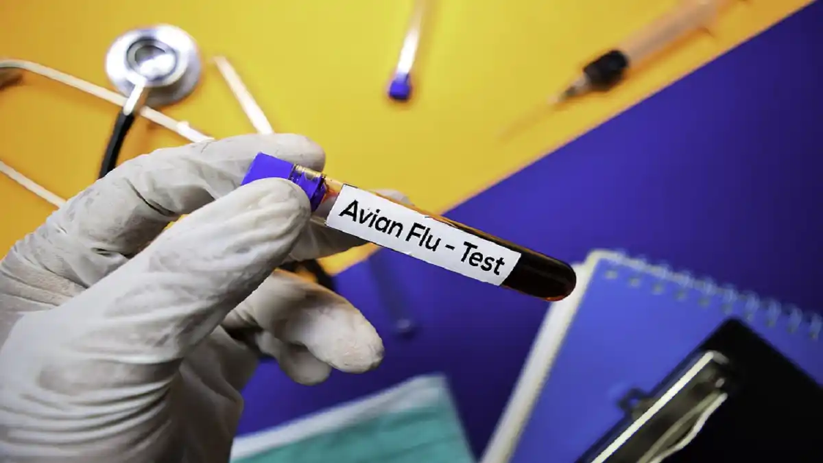 EE.UU. reporta primer caso de gripe aviar sin contacto conocido con animales