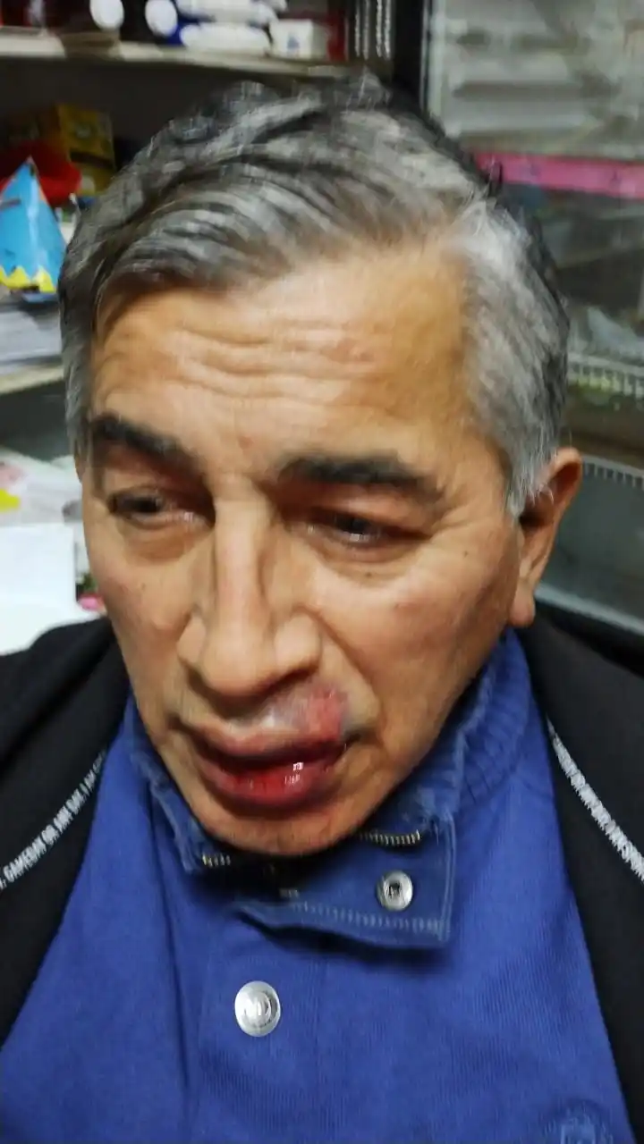 Morón: Denuncian que en McDonald's golpearon a un abuelo delante de su nieta "por no saber usar el autoservicio"