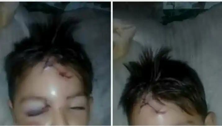 Un niño fue atacado por un perro y terminó internado