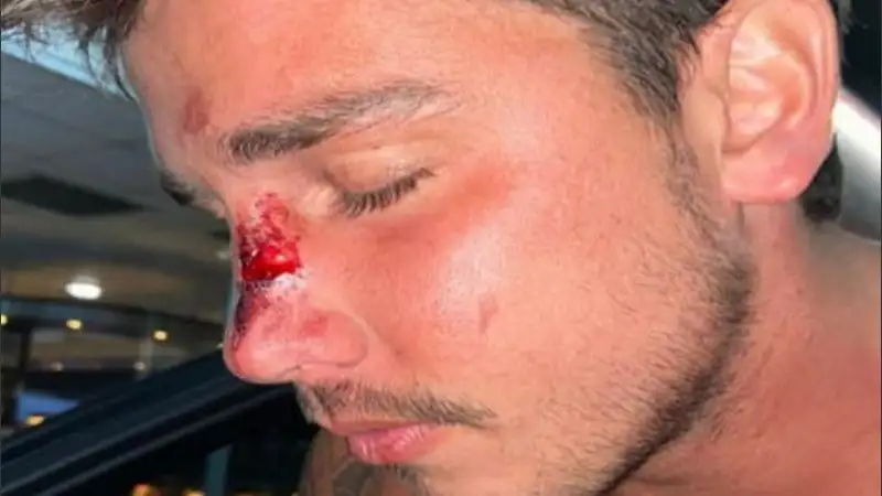 Roldán: un joven denunció que fue golpeado por rugbiers