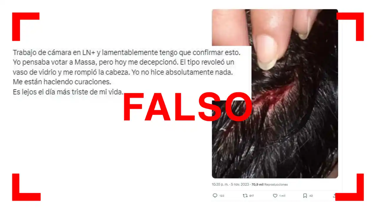 Esta imagen que muestra una supuesta herida provocada por Sergio Massa en LN+ es de 2020 y no está relacionada con el candidato.