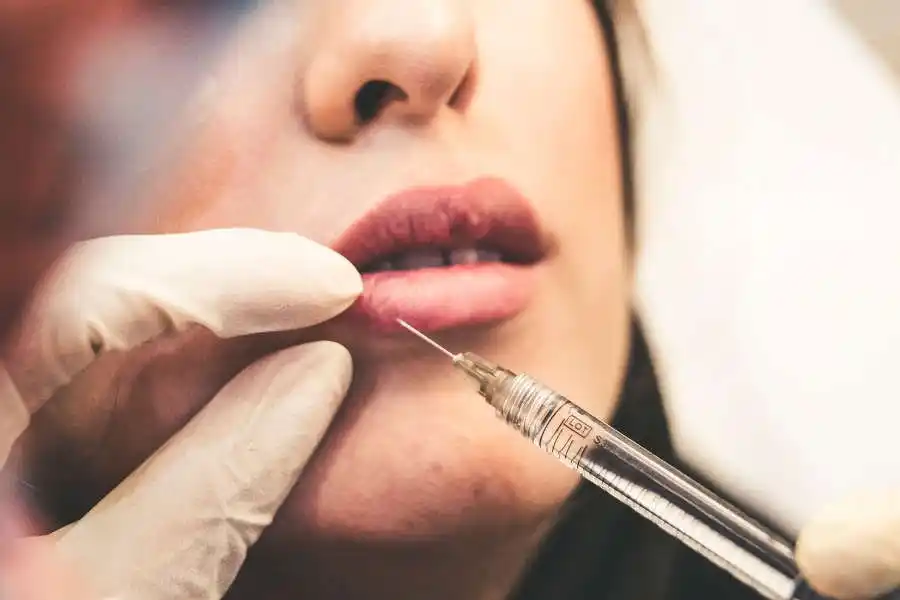 Quiso hacerse un retoque en los labios y se le fue la mano 