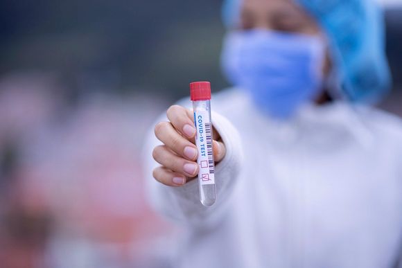 Coronavirus: informaron otros 9 casos positivos