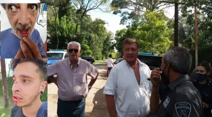 Grave denuncia contra un funcionario de San Miguel y sus hijos rugbiers por una brutal paliza durante una pelea de tránsito 