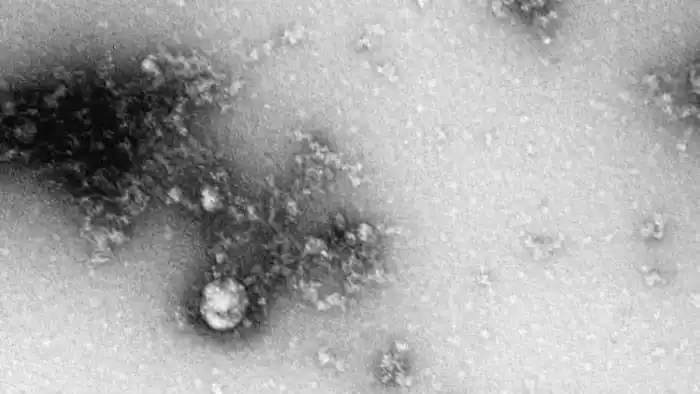 Científicos rusos toman la primera  «fotografía» de la cepa británica del coronavirus
