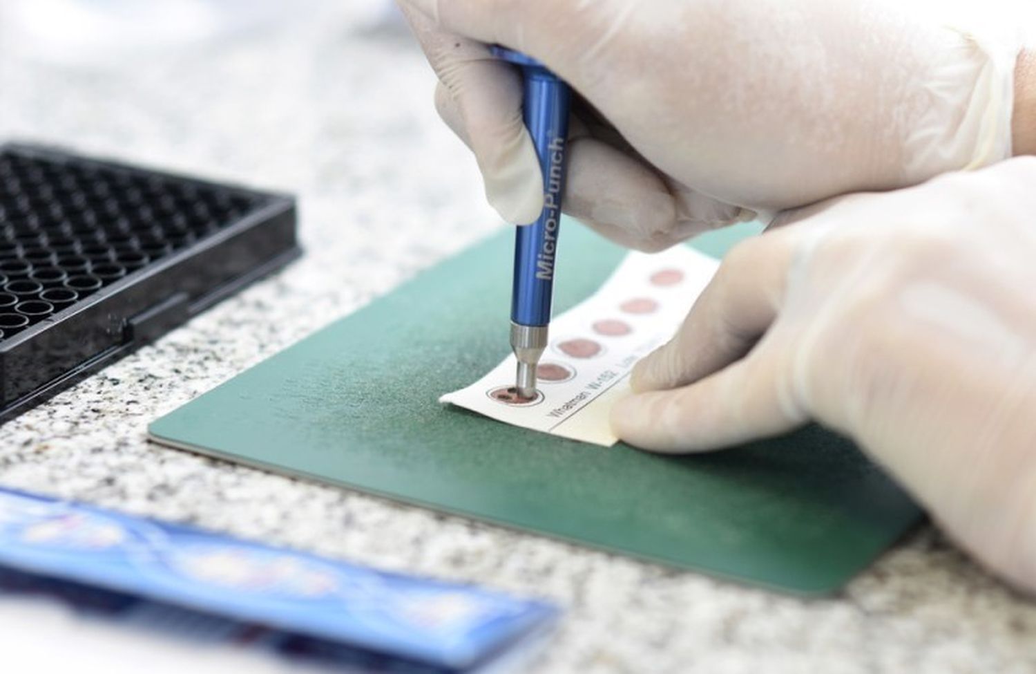 Antígenos, PCR y serológicos: qué diferencia hay entre los test y cuándo se utilizan