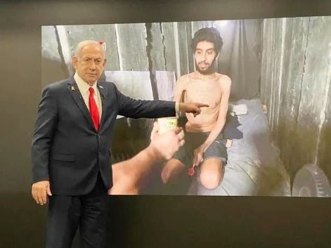 Para Israel, el informe de la ONU sobre el hambre en Gaza es “una mentira descarada”