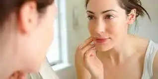 Cómo mantener la rosacea bajo control