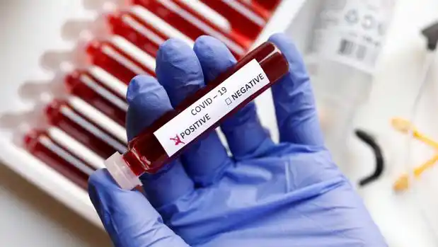 Coronavirus: 14 positivos entre los 65 resultados informados este jueves
