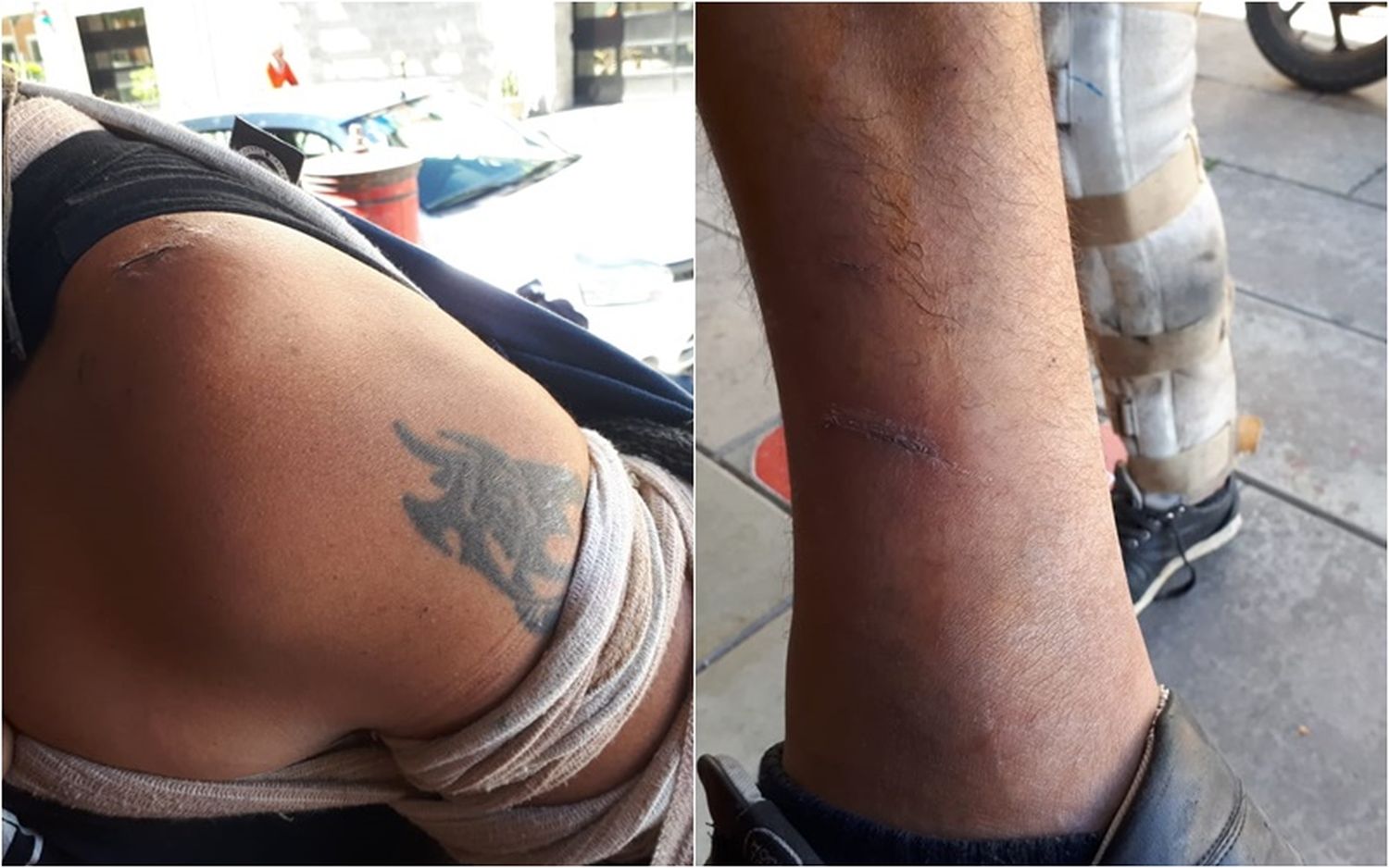 Mensajero denunció que, dos veces, perros salieron de una casa y lo atacaron y lesionaron