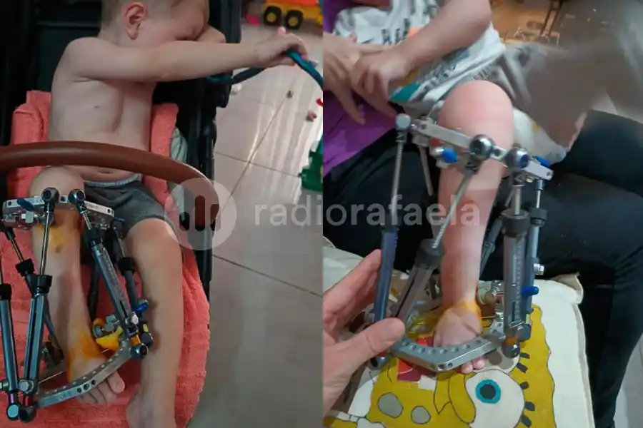 Corte de Iapos: la lucha de una madre para operar a su hijo 