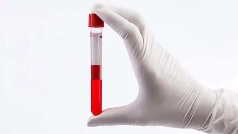 Crean el primer análisis de sangre capaz de detectar melanomas
