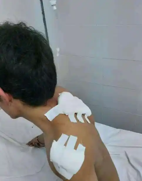 Un joven apuñaló a un compañero del colegio porque se puso de novio con su hermana