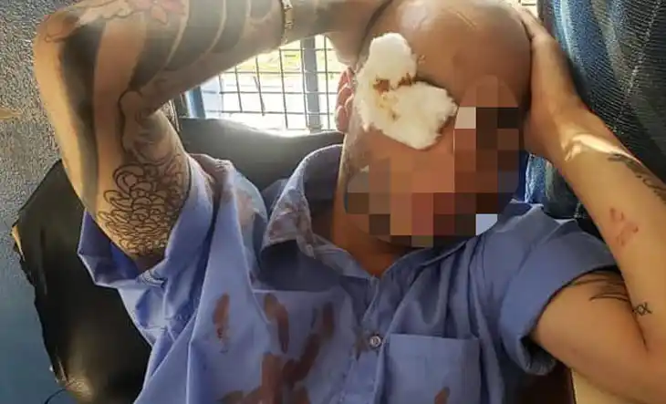 Un colectivero de la línea 622 terminó internado tras ser atacado a botellazos en La Matanza