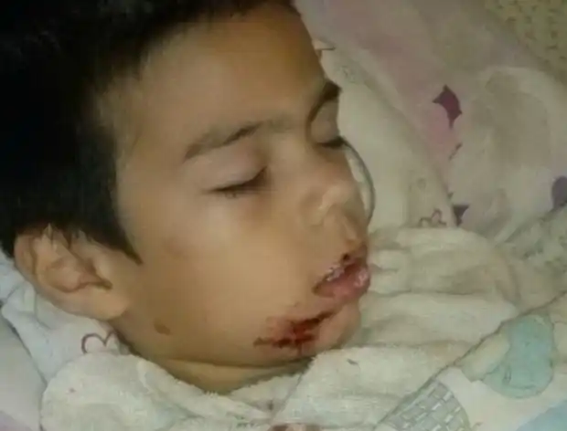 Otro niño fue atacado por un perro callejero en la plaza San Martín  