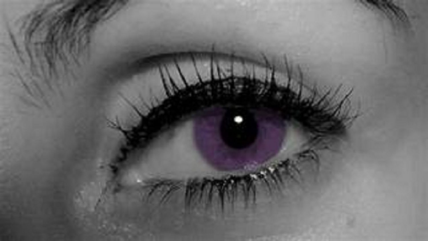 OJOS VIOLETA o «síndrome de Alejandría»: lo que se sabe de esta rara condición
