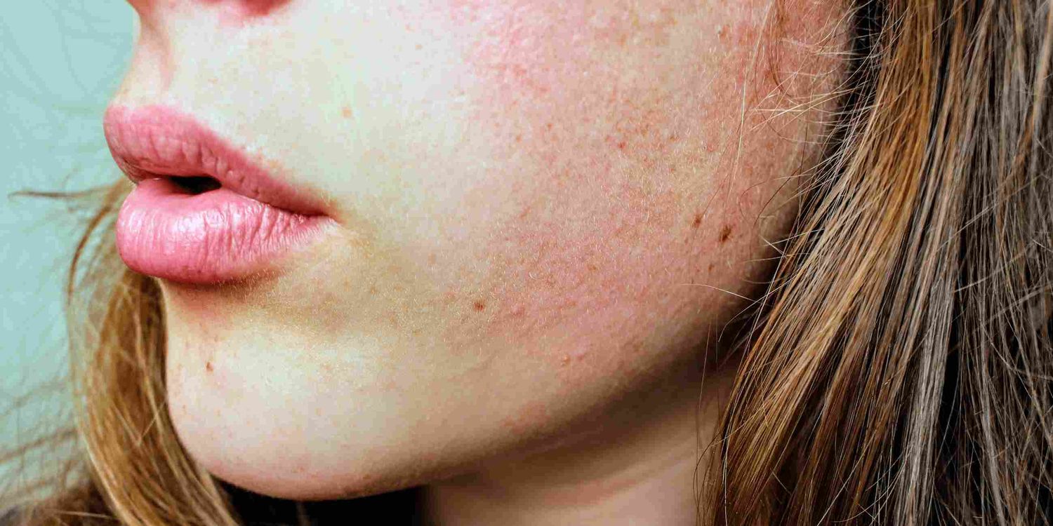 Hace frío y la piel también lo sufre: 10 consejos para cuidarla del invierno extremo