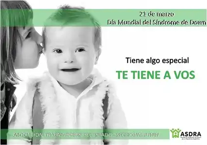 Hoy se conmemora el Día Mundial del Síndrome de Down