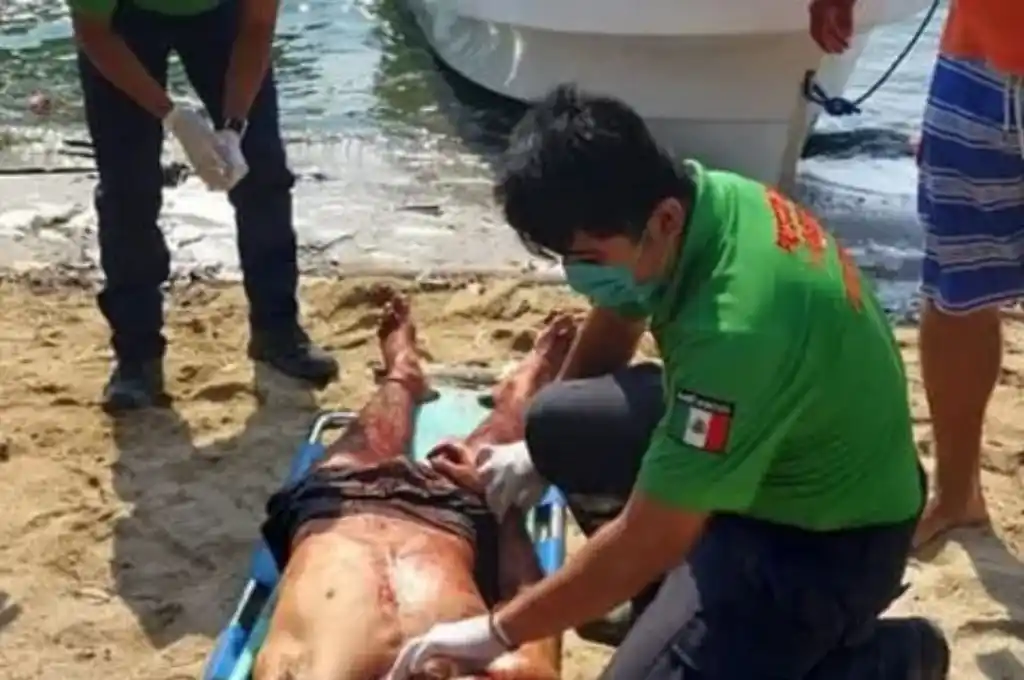 Atacaron a machetazos a tres argentinos en una playa de México
