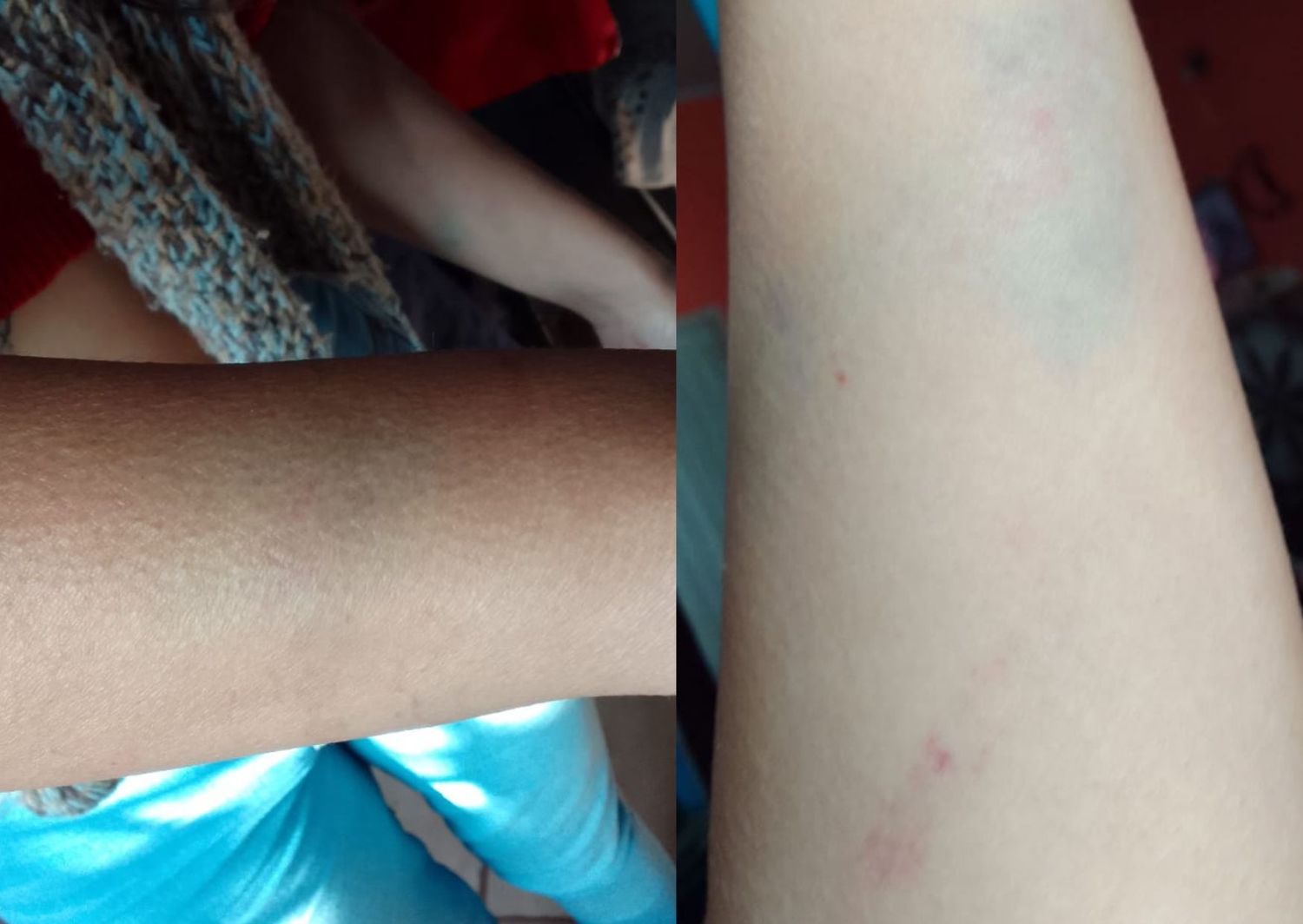 Violencia de género: su expareja la golpeó, robó su documentación y no pudo denunciar