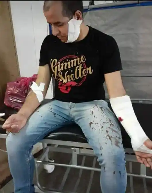 Moreno: Acuchillaron a un colectivero a 4 cuadras de la Municipalidad y hay 6 líneas de paro