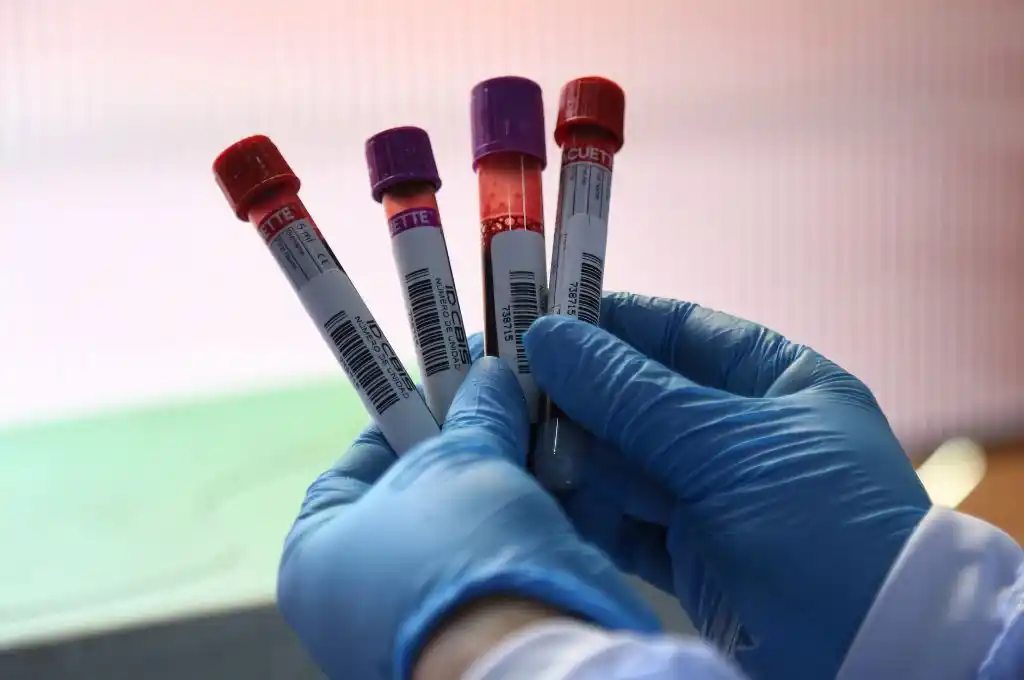 Un estudio científico revela que la sangre de ciclistas de élite podría ayudar a prevenir enfermedades