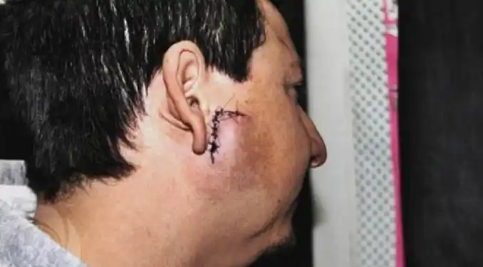 Tres Arroyos: Le gritaron groserías a una mujer y terminaron en el hospital