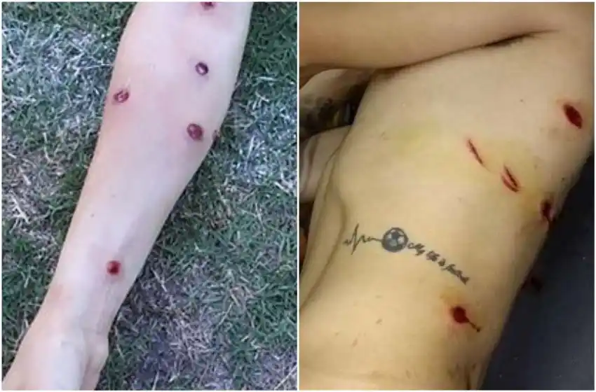 Jugadores reprimidos en un partido de fútbol en Armstrong