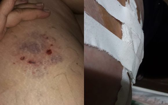 Perros atacaron y mordieron a una mujer: “¿Nadie puede hacer nada?”, se quejó