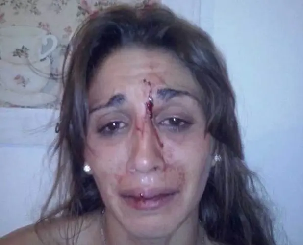 Otra vez los patovicas: Violento ataque en un boliche de Ringuelet